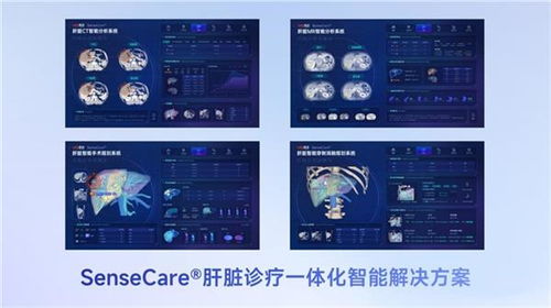 商湯醫(yī)療獲肝臟CT輔助診斷NMPA三類(lèi)證，軟硬件零售賦能肝臟診療一體化新格局